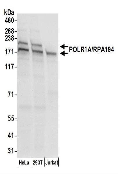 Anti-POLR1A/RPA194