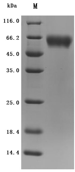 Interleukin-1 receptor accessory protein (IL1RAP), partial (Active), human, recombinant