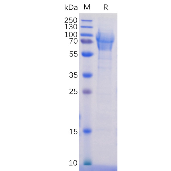 Human CD162 Protein, His Tag