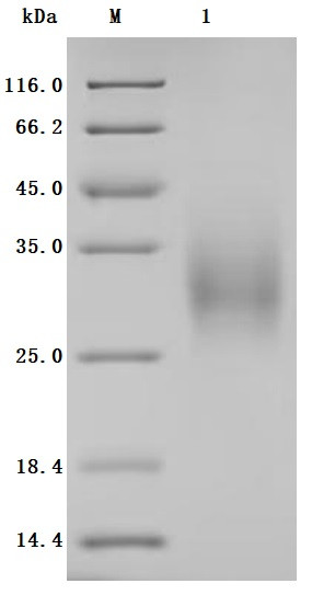 B- and T-lymphocyte attenuator (BTLA), partial (Active), human, recombinant