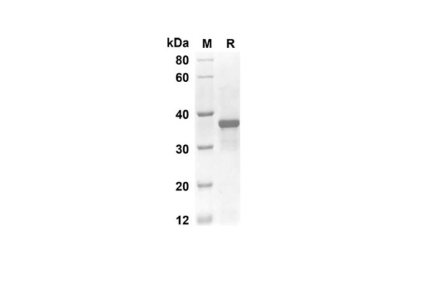 EGF Protein (Gst Tag) (recombinant rat)