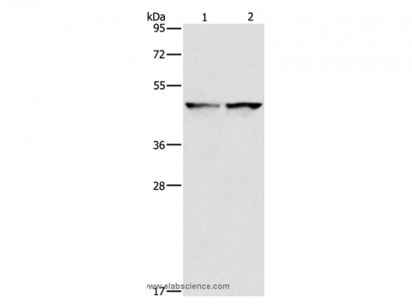 Anti-IDH1