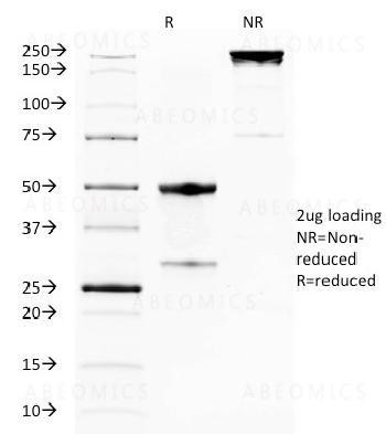 Anti-GITR / Tnfrsf18 (Mouse) Monoclonal Antibody (Clone: DTA-1)