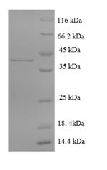 Cathepsin G (Ctsg), mouse, recombinant