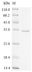 High affinity immunoglobulin gamma Fc receptor I (FCGR1A), partial, human, recombinant