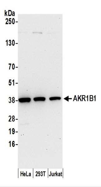 Anti-AKR1B1