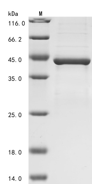 Nitric oxide synthase, inducible (NOS2),partial, human, recombinant