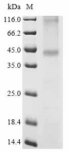 Somatostatin receptor type 2 (SSTR2), human, recombinant