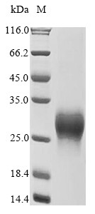 Gastric inhibitory polypeptide receptor (GIPR), partial, human, recombinant