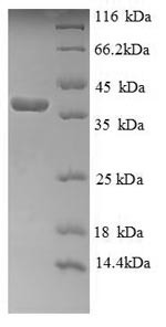 Cytochrome c (CYCS), human, recombinant