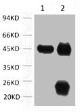 Anti-ACTA1 Monoclonal