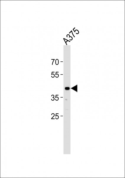 Anti-SIRPB1