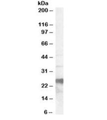 Anti-PrP