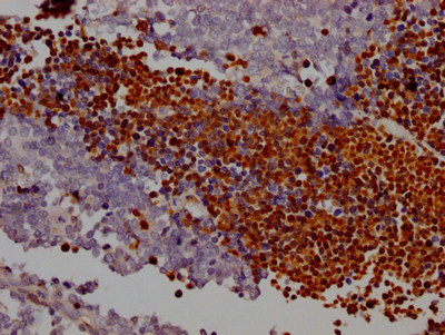 Anti-PARP1 Recombinant Monoclonal, clone 5H8