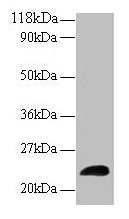 Anti-LCN2