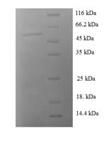 14-3-3 protein sigma (SFN), human, recombinant