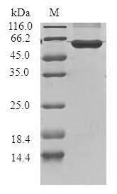 G1/S-specific cyclin-D3 (CCND3), human, recombinant