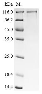 Cancer-associated gene 1 protein (CAGE1), human, recombinant