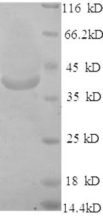 Very long-chain acyl-CoA synthetase (SLC27A2), partial, human, recombinant