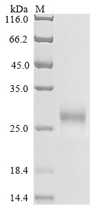 Low affinity immunoglobulin gamma Fc region receptor II-b (FCGR2B), partial, human, recombinant