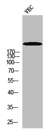 Anti-Phospho-POLR2A (S1619)