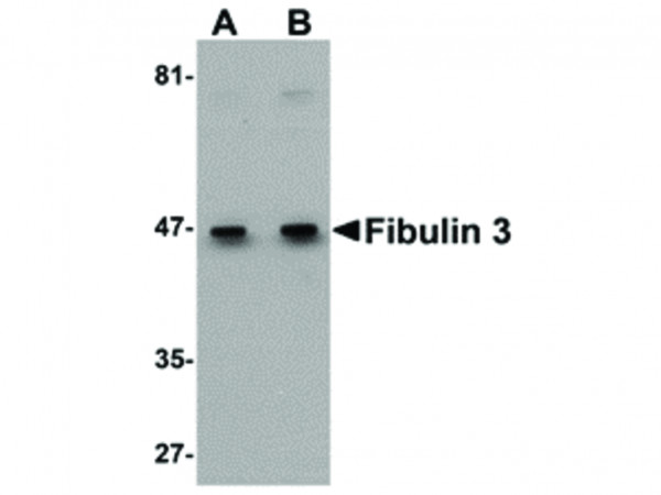 Anti-Fibulin 3