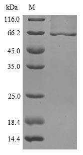 Lysosomal acid Glucosylceramidase (Gbal), mouse, recombinant