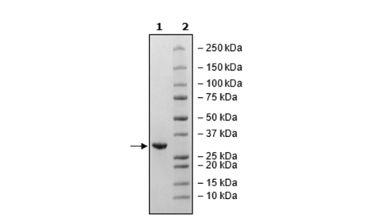 3CL Protease (T21I, T304I) (SARS-CoV-2) Recombinant