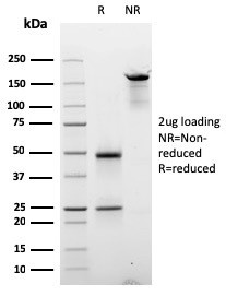 Anti-Cyclin E (G1/S-Phase Cyclin)(CCNE1/2587), Biotin conjugate, 0.1mg/mL