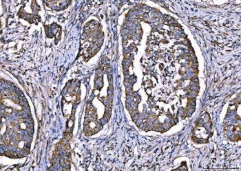 Anti-CPT1A / Carnitine O-palmitoyltransferase 1