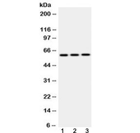 Anti-EPHX2 / Epoxide hydrolase 2