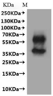 B-lymphocyte antigen CD20 (Ms4a1)-VLPs, mouse, recombinant