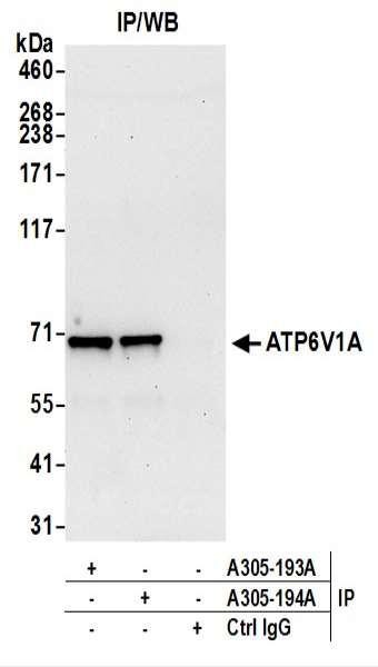 Anti-ATP6V1A