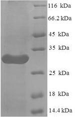 Leukocyte immunoglobulin-like receptor subfamily A member 5 (LILRA5), partial, human, recombinant