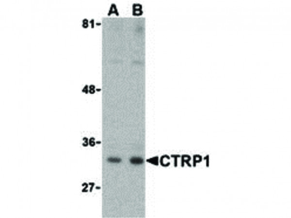 Anti-CTRP1