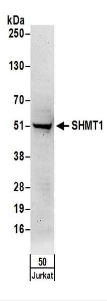 Anti-SHMT1