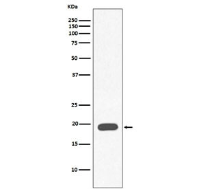 Anti-Myoglobin, clone FOD-13