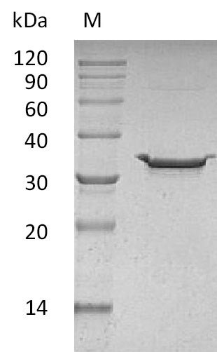 Carbonic anhydrase 5B, mitochondrial (CA5B) (Active), human, recombinant