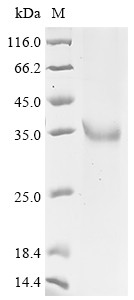 L-lactate dehydrogenase C chain (LDHC), human, recombinant