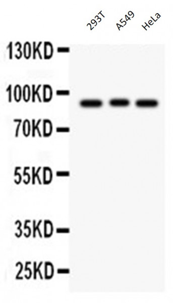 Anti-Semaphorin 3A