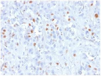 Anti-p21WAF1 (Tumor Suppressor Protein) Recombinant Mouse Monoclonal Antibody (clone:rCIP1/823)