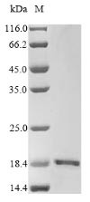 Glutamate receptor ionotropic, NMDA 2A (GRIN2A),partial, human, recombinant