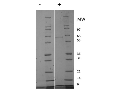 Insulin-like Growth Factor I (AF)