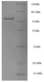 Homeobox protein NANOG (NANOG), human, recombinant