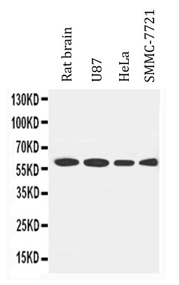 Anti-LCAT / Lecithin Cholesterol Acyltransferase