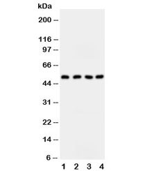 Anti-SPTLC1