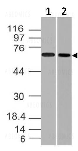 Anti-Endoglin