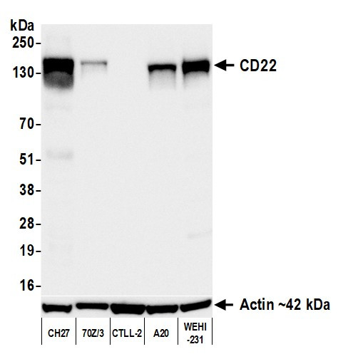 Anti-CD22 Recombinant Monoclonal