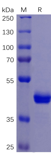 Human TNFRSF10B Protein, mFc Tag