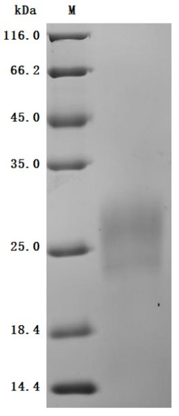 Gastric inhibitory polypeptide receptor(GIPR),partial (Active), human, recombinant